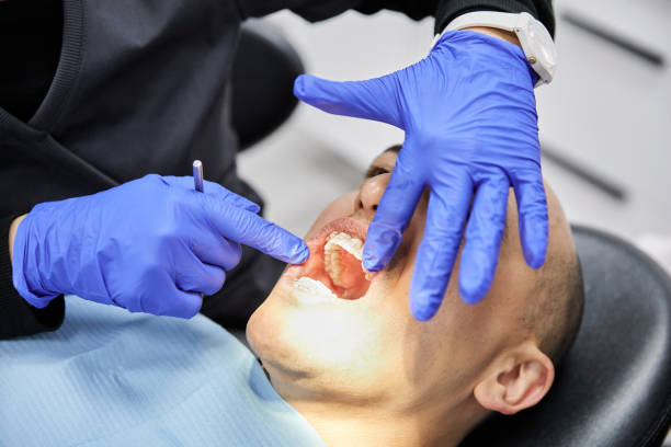 Best Dentist for Tooth Abscess  in Denver City, TX